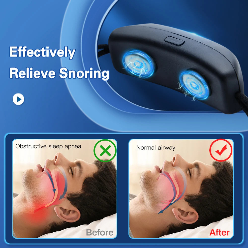 Smart EMS Anti-Snoring Device – Portable Sleep Apnea Aid